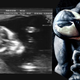 Illustration for article titled Sonogram reveals that woman is giving birth to the supervillain Venom